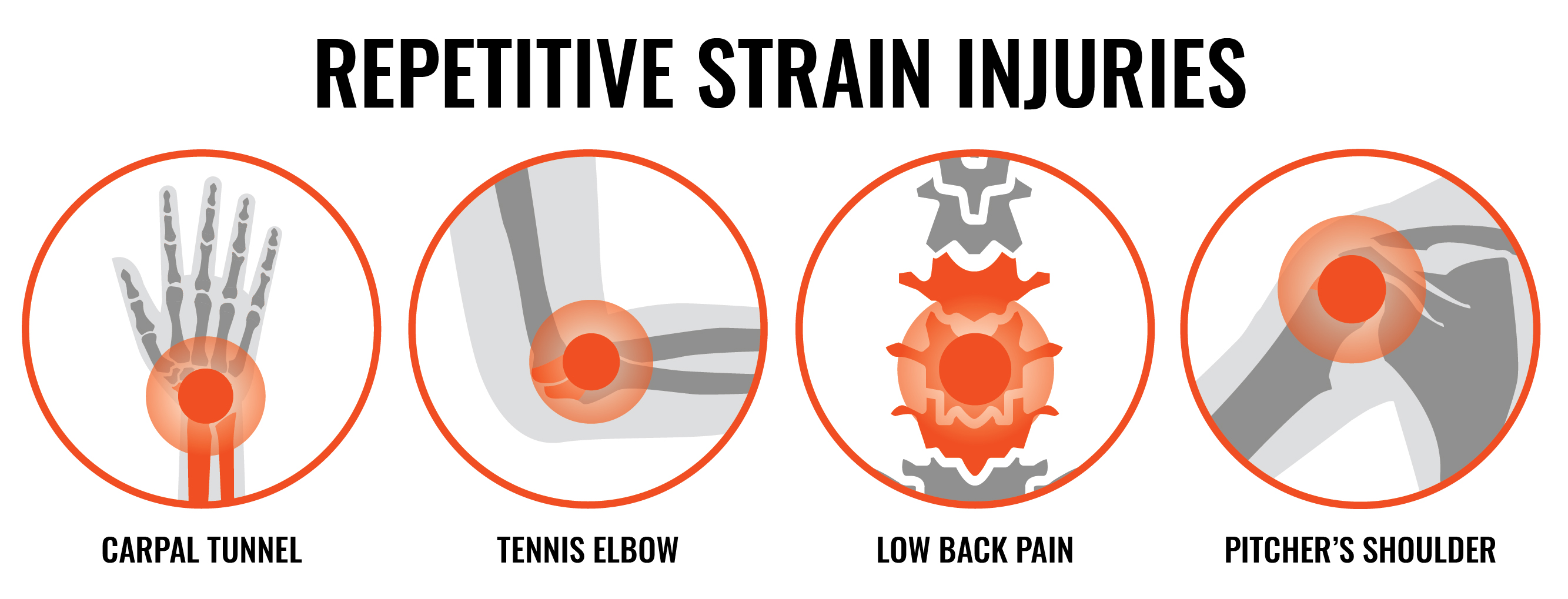 carpal tunnel, tennis elbow, low back pain, pitcher's shoulder